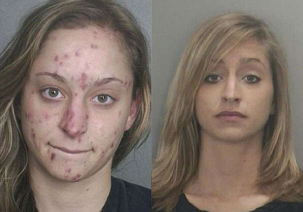 The Yo App Can Even Reverse The Effects of Heavy Meth Use!